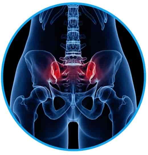 Pelvic pain